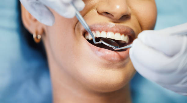 Best Walk-In Emergency Dentist in Jerseyvle, IL
