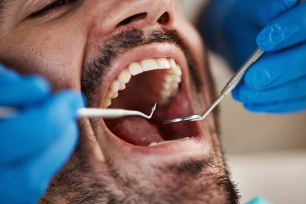 Best Emergency Root Canal Treatment in Jerseyvle, IL